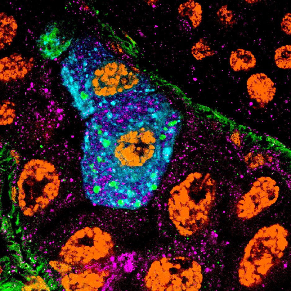 Another week, another #FluorescenceFriday,the first one showing a mystery mutant cell with gigantic mitochondria that I was just discussing with @BaehreckeLab ….. the second I just liked how it turned out 😀