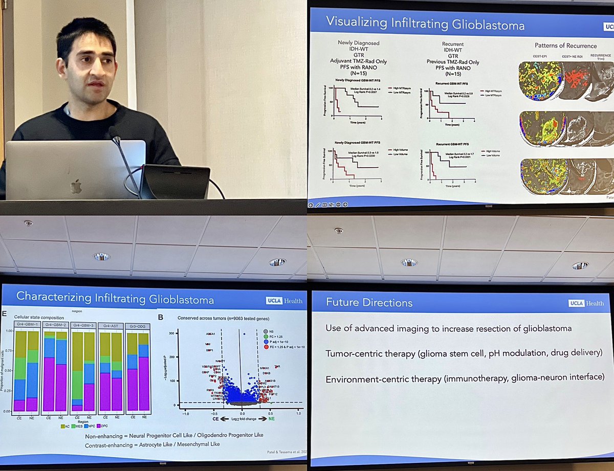 At the neural repair seminar talk by Dr. Patel @dgsomucla @IsaacYangMD @UCLANsgy @UCLAHealth @HarborUCLA