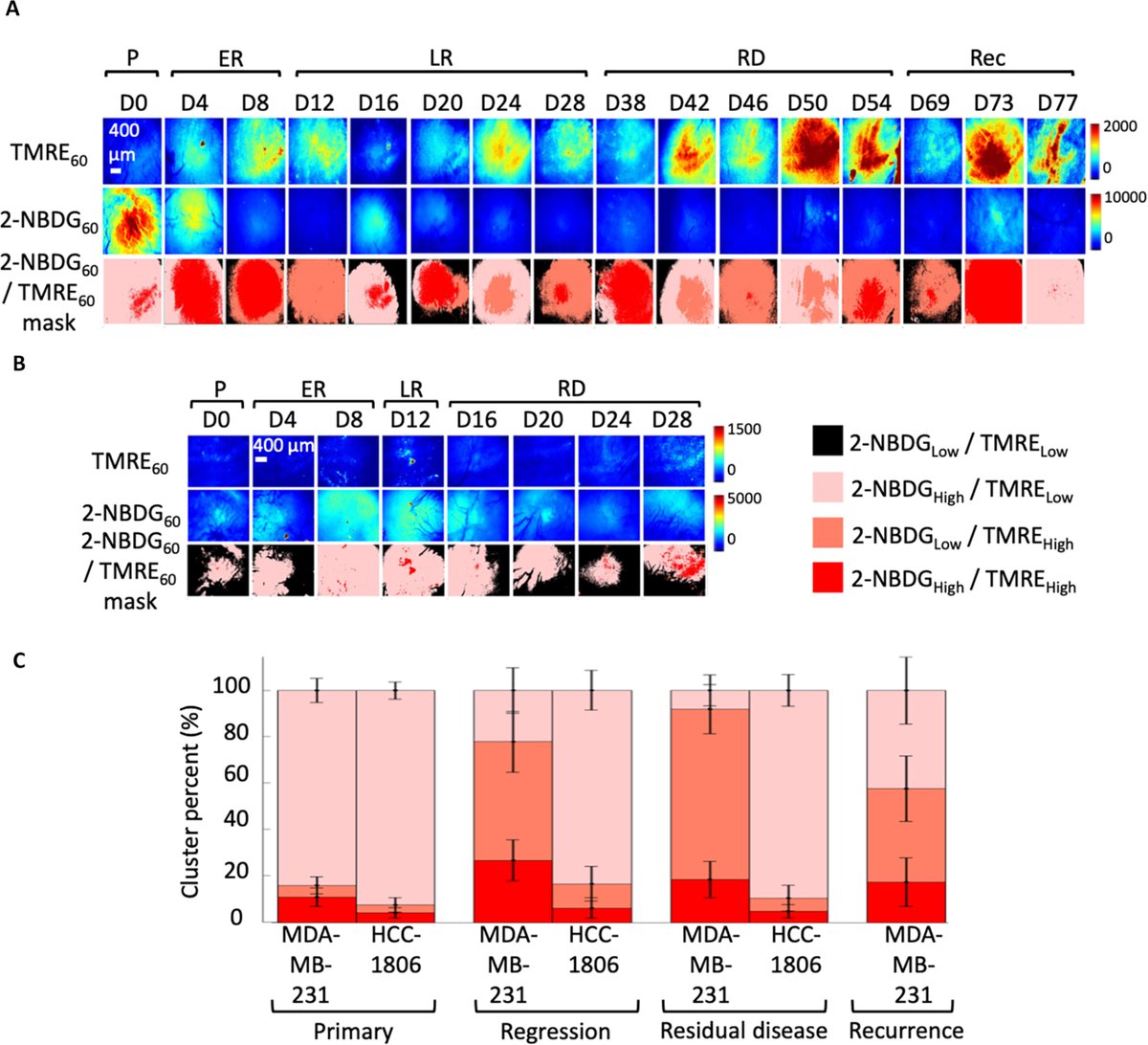 Researchers have developed an optical microscopy platform for imaging metabolic pathways and showed that tracking metabolic changes is important for comparing tumor responses to chemotherapy. @Enakshi_devi scim.ag/6uC