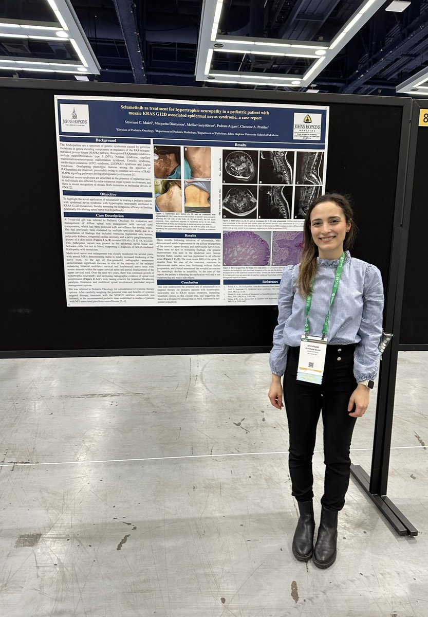 Excited to be able to present my poster @ASPHO_hq about the use of selumetinib for hypertrophic neuropathy in a pediatric patient with mosaic KRASopathy. Many thanks to @CPratilasMD for the outstanding mentorship, Dr. Rita Dionysiou for the support and everyone else who helped.