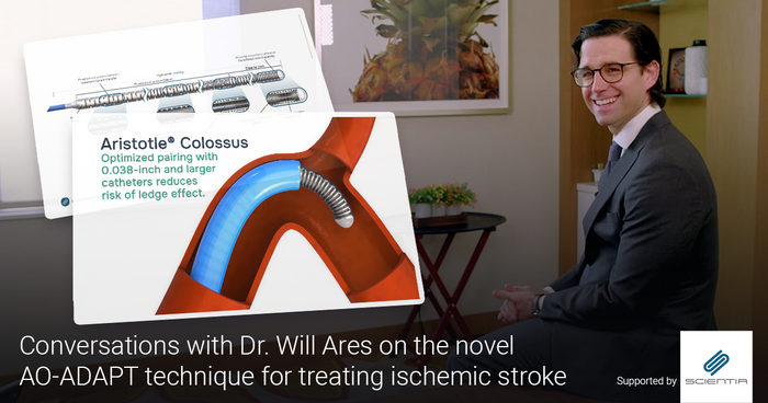 Based on the 'Aristotle®-Only Direct Aspiration First-Pass Technique for Endovascular Mechanical #Thrombectomy' study, @brainvesseldoc reveals the efficacy of the AO-ADAPT technique for revascularization using an #Aristotle ® 24 guidewire! Don't miss out: ow.ly/JGmj50R6p2l