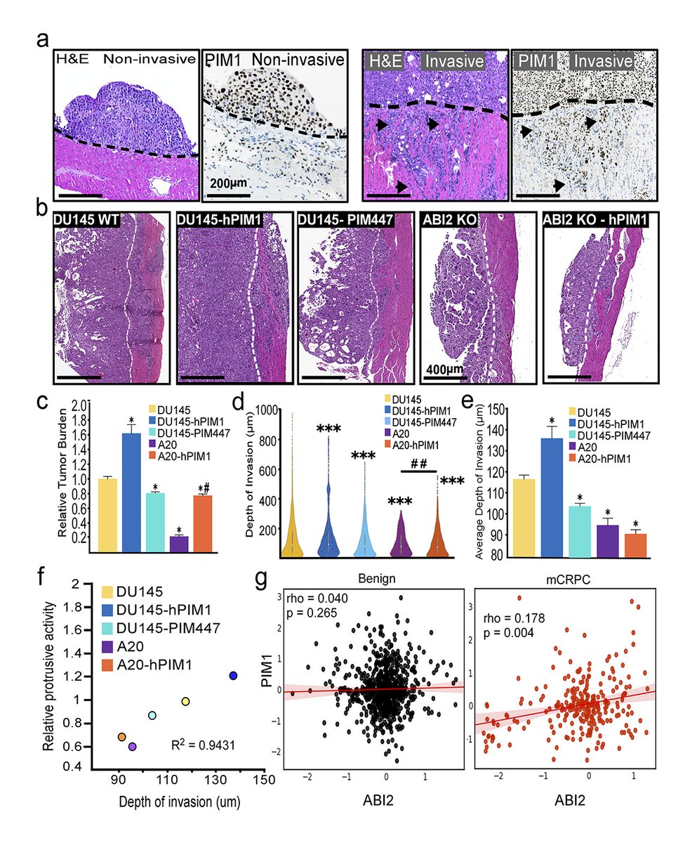 JCellBiol's tweet image. .@Dr_Dioxide14 et al @Warfellab identify a new role for PIM1 as a critical regulator of #actin dynamics &amp;amp; #hypoxia-induced cell #migration. hubs.la/Q02ry-9l0

From our #Cancer Cell Biology collection: hubs.la/Q02rz3h_0  #AACR2024