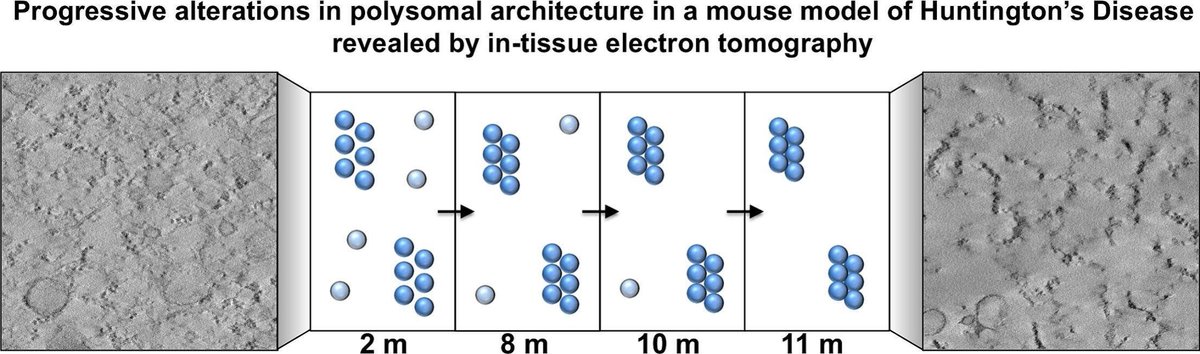 El grupo de Arquitectura subcelular del #ISPA describe alteraciones en la arquitectura polisomal neuronal en modelos animales de la enfermedad de Huntington estudiadas mediante microscopía electrónica tridimensional y técnicas moleculares. doi.org/10.1016/j.nbd.…