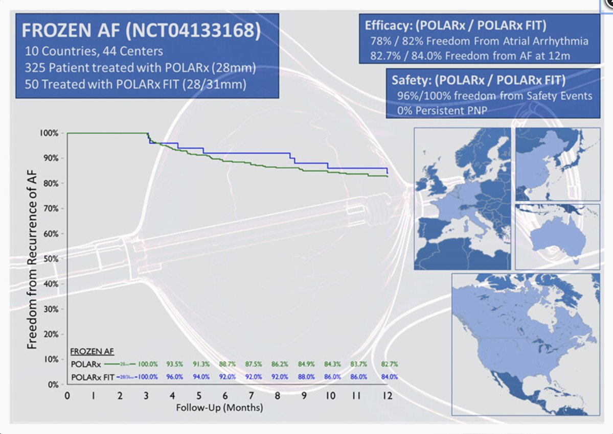 ‼️New in @JCardioEP‼️ 📜 One year outcomes of the FROZEN AF Trial 👓 PVI with a novel cryoboalloon is safe and effective with 79.9% freedom from atrial arrhythmia and 96% freedom from safety endpoints at 1y. ✒️ @KennethEllenbo1 @su_wilber et al 🔗 tinyurl.com/yfkw6ca8