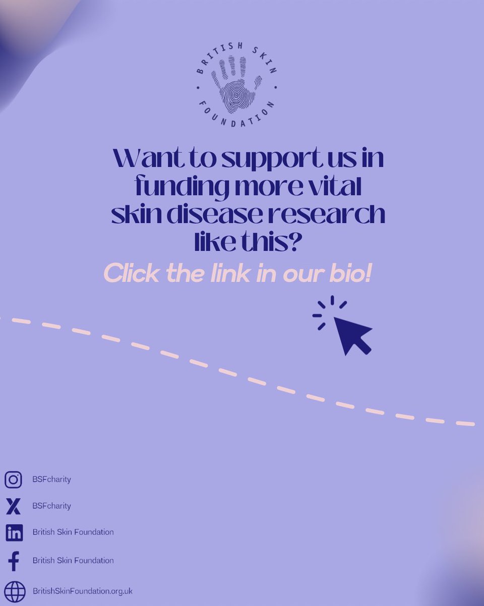 British Skin Foundation (@bsfcharity) on Twitter photo Happy Friday! Starting the weekend off right by shining the light on some amazing BSF-funded research into actinic keratoses!
To find out more about our work & support us, visit our website: britishskinfoundation.org.uk
<a href="/SkinSvhg/">SVHG Skin Cancer Network</a>
#BritishSkinFoundation #SkinResearch #Dermatology Happy Friday! Starting the weekend off right by shining the light on some amazing BSF-funded research into actinic keratoses!
To find out more about our work & support us, visit our website: britishskinfoundation.org.uk
<a href="/SkinSvhg/">SVHG Skin Cancer Network</a>
#BritishSkinFoundation #SkinResearch #Dermatology