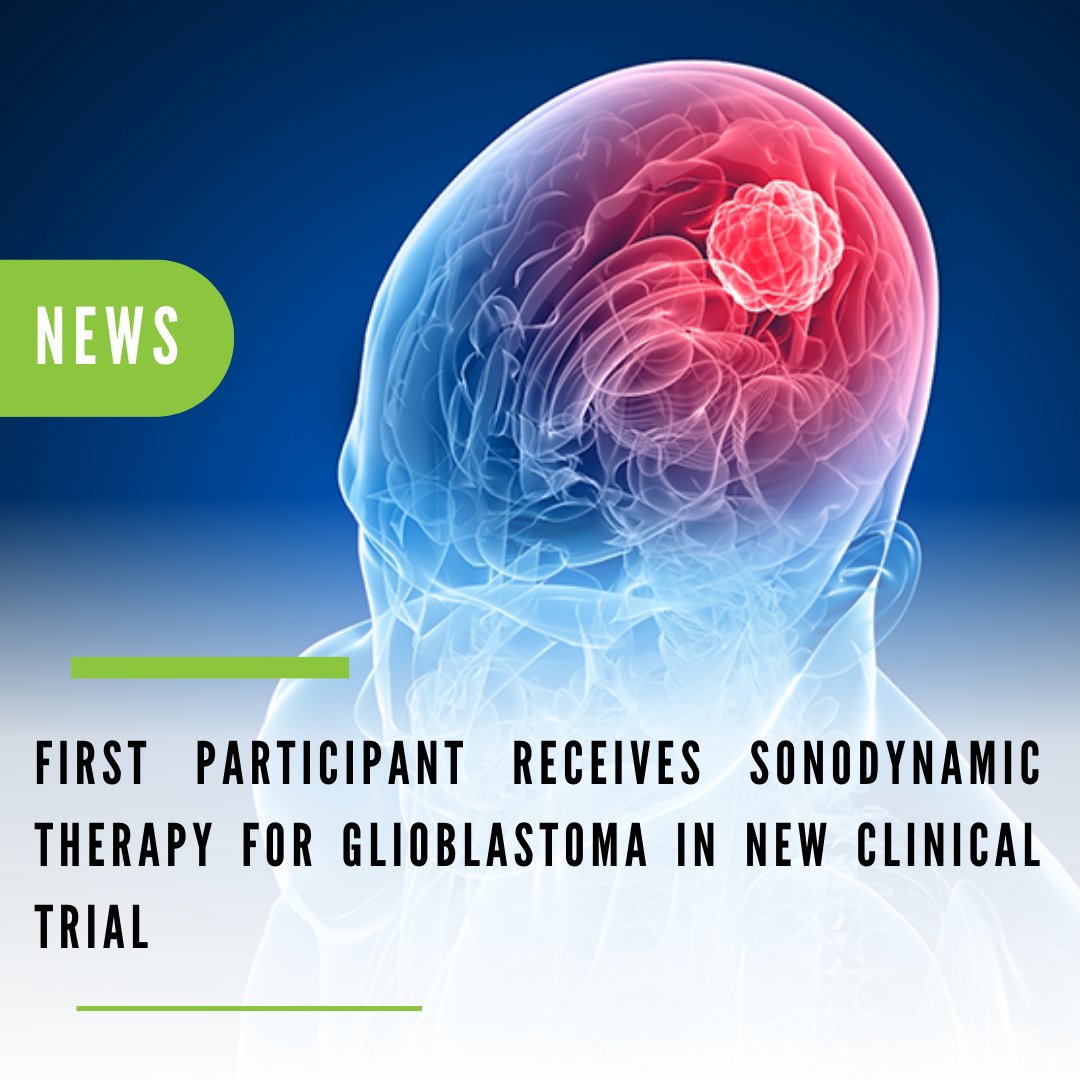 The first participant received sonodynamic therapy (SDT) in a new clinical trial investigating the safety and feasibility of using SDT in patients with recurrent glioblastoma (GBM).  Learn more at ecs.page.link/3mkxw #SDT #BrainTumor #CancerTreatment