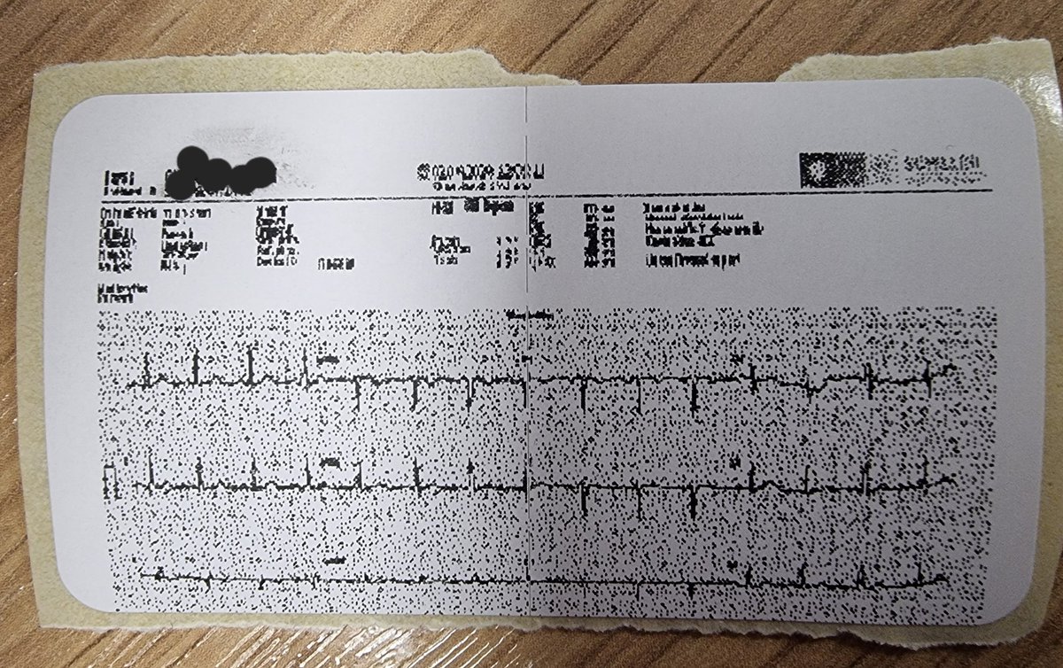 Our HCA took great pleasure in presenting me with this earlier, for my opinion... My opinion is that I'm thoroughly unimpressed with #NHS IT today. Yes, this is an #ECG that her computer inexplicably printed onto a blood tube label 🤦🏻‍♀️ Is this a microcardiogram?!