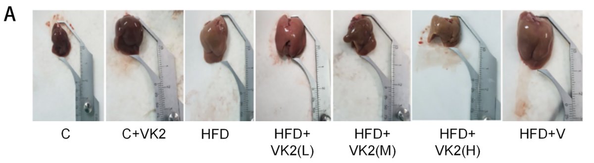 Outdoctrination's tweet photo. Low dose vitamin K2 reverses fatty liver disease.

Less than 1 mg (human equivalent dose) MK-7 daily completely protects and regenerates the liver.

High liver enzymes (ALT, AST, GGT, ALP) are the red flag - would consider supplementation.