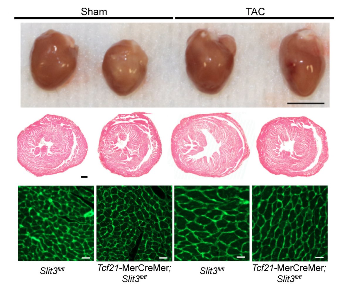 Liu & colleagues found #SLIT3 can directly stimulate #cardiomyocyte #hypertrophy via the #ROBO1 receptor. Learn more about this novel cardiac #stromal cell-cardiomyocyte axis which causes adverse remodeling at ahajournals.org/doi/10.1161/CI…