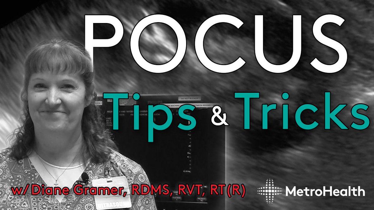 Do you want to take your scans from good to great? Check out the latest video with @DianeGramer POCUS Tips & Tricks. youtu.be/t9adkp1JU_g #MetroEUS #POCUS #Ultrasound