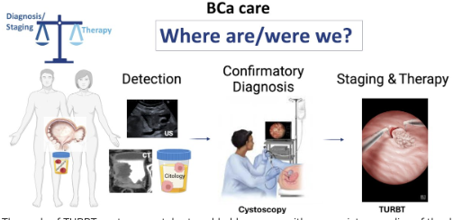 UroToday.com tweet media
