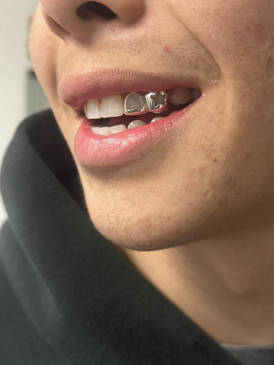 Fred Bennett Jr (@206goldgrills) / Posts / X