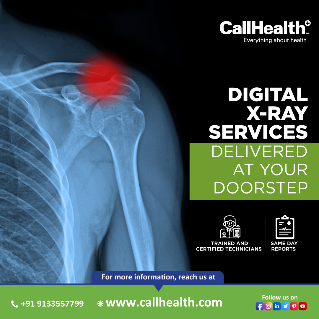 Customer Convenience is our Priority! #CallHealth in its endeavor to make healthcare accessible has started X-ray at Home service for residents. Schedule Your Appointment Now! Call Us: 9133557799 CallHealth - #EverythingAboutHealth #medicalimaging #diagnostics #MedicalAssistant