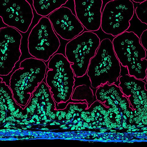 Happy #FluorescenceFriday from Long Beach, CA. Enjoying all of the GI research at #APS2024 and the incredible talks. 

#FluorescentFriday #bioart #sciart #bioart #pathart #histoart #microscopy