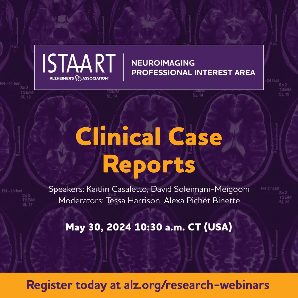 Join us on May 30th for our @ISTAART #NeuroimagingPIA Clinical Case Report webinar, lead by Kaitlin Casaletto and David Soleimani-Meigooni @kbcasaletto @UCSF @RabLab_UCSF 🧠📢 🗓️Date: May 30th, 10.30 am CT / 5.30 PM CET 💻Register: alz-org.zoom.us/webinar/regist…