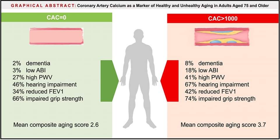 🔴 Coronary artery calcium as a marker of healthy and unhealthy aging in adults aged 75 and older: The Atherosclerosis Risk in Communities (ARIC) study @ATHjournal atherosclerosis-journal.com/article/S0021-… #Diagnosis #MedEd #MedX #ECG #ekg #CardioEd #Cardiology #cardiotwitter