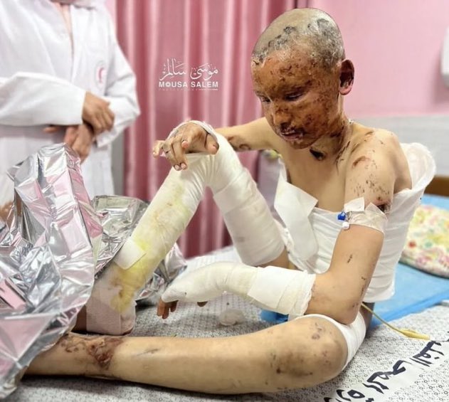 DrLoupis's tweet photo. Hi @israel

Was this child also a “Hamas Terrorist”? https://t.co/fzvXJjStkJ