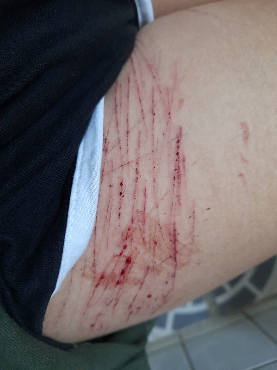 Nugg3tShark's tweet photo. I love self-harm so much <//3 https://t.co/YvIdqMSxaF
