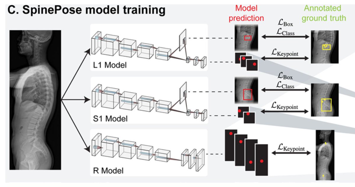 emerse (@projectemerse) on Twitter photo EMERSE identified patients who underwent whole-spine radiography for study, "Development and validation of an artificial intelligence model..."
<a href="/SamirHarake/">Samir Harake</a> <a href="/joseph_linzey/">Joseph Linzey, MD, MS</a> <a href="/__chengjia__/">Cheng Jiang</a> <a href="/RushiSJoshi7/">Rushikesh Joshi, MD</a> <a href="/MarkZaki24/">Mark Zaki</a> <a href="/SiriKhalsaMD/">Siri Sahib Khalsa, MD</a> <a href="/ZWilseckMD/">Zachary Wilseck</a> <a href="/ToddCHollon/">Todd Hollon</a>
thejns.org/spine/view/jou… EMERSE identified patients who underwent whole-spine radiography for study, "Development and validation of an artificial intelligence model..."
<a href="/SamirHarake/">Samir Harake</a> <a href="/joseph_linzey/">Joseph Linzey, MD, MS</a> <a href="/__chengjia__/">Cheng Jiang</a> <a href="/RushiSJoshi7/">Rushikesh Joshi, MD</a> <a href="/MarkZaki24/">Mark Zaki</a> <a href="/SiriKhalsaMD/">Siri Sahib Khalsa, MD</a> <a href="/ZWilseckMD/">Zachary Wilseck</a> <a href="/ToddCHollon/">Todd Hollon</a>
thejns.org/spine/view/jou…