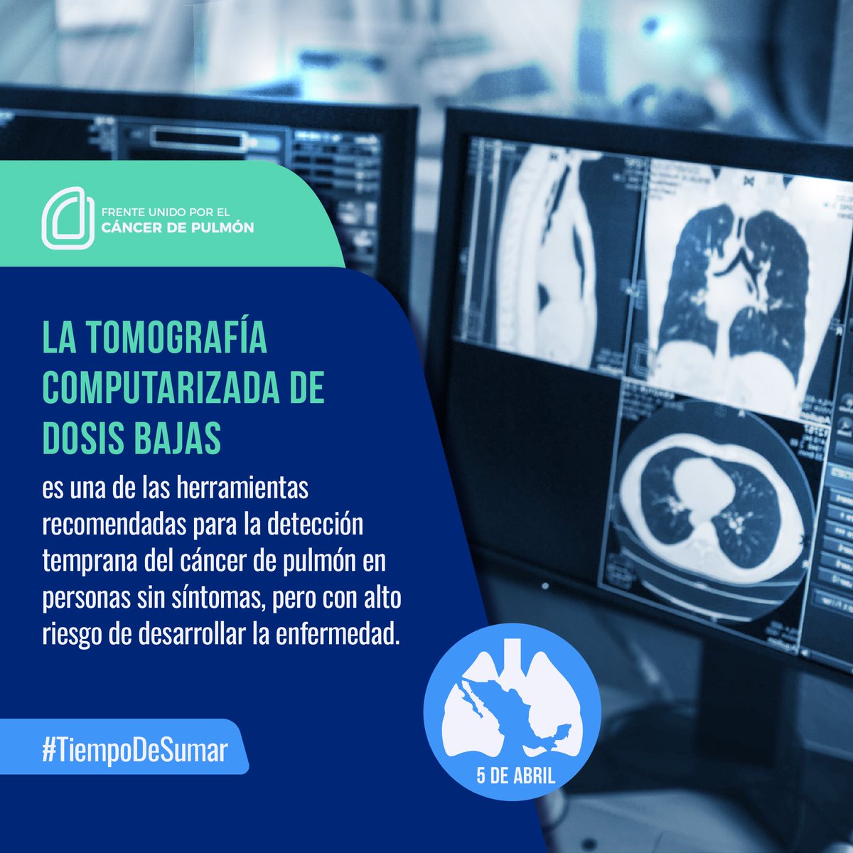 ¿Qué es la tomografía computarizada de dosis bajas? Es una de las herramientas más recomendadas para la detección oportuna del #CáncerDePulmón en personas que no presentan síntomas. #TiempoDeSumar