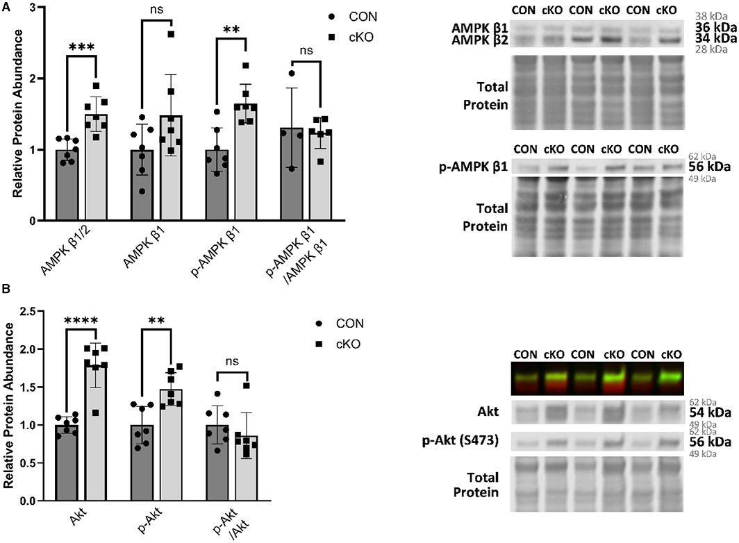 JAHA (@jaha_aha) on Twitter photo A new target for diabetic cardiomyopathy and heart failure? <a href="/harold_kylene/">Kylene Harold</a> <a href="/Ken_Humphries/">Ken Humphries</a> et al. introduce a cardiomyocyte specific PFKFB2 knockout model, revealing its crucial role in cardiac metabolism and pathogenesis. #AHAJournals <a href="/AM_OMRF/">Aging and Metabolism Research Program</a> ahajournals.org/doi/10.1161/JA… A new target for diabetic cardiomyopathy and heart failure? <a href="/harold_kylene/">Kylene Harold</a> <a href="/Ken_Humphries/">Ken Humphries</a> et al. introduce a cardiomyocyte specific PFKFB2 knockout model, revealing its crucial role in cardiac metabolism and pathogenesis. #AHAJournals <a href="/AM_OMRF/">Aging and Metabolism Research Program</a> ahajournals.org/doi/10.1161/JA…