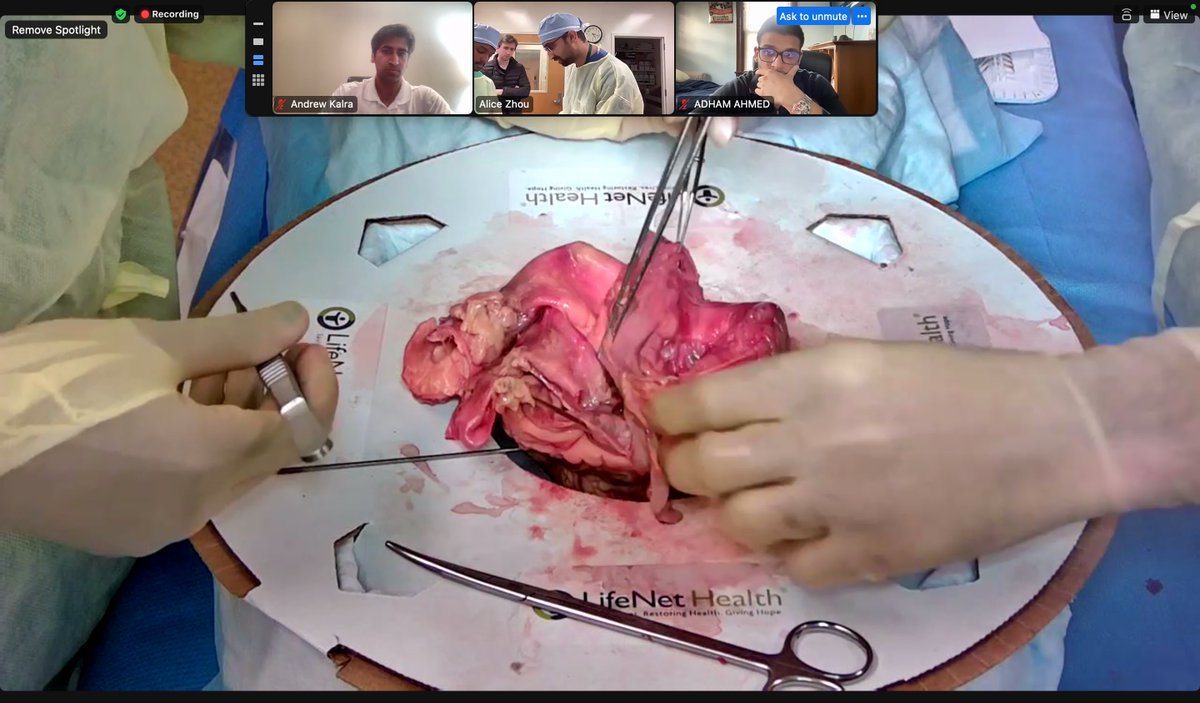 AdhamAhmedMD's tweet photo. What an afternoon! Beautiful walk-through of cardiac anatomy, cannulation, and technical considerations by @DevenPatelMD of @HopkinsCTSurg. Huge shout-outs to @LNHFoundation @AliceLiZhou  @armaan_akbar for setting up this session. Hope to see everyone at next week's event  :) https://t.co/XYd0Fk91Vc