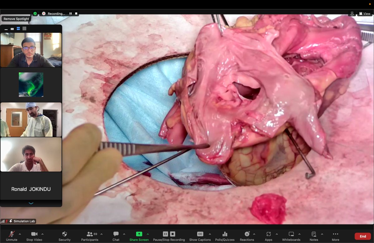 AdhamAhmedMD's tweet photo. What an afternoon! Beautiful walk-through of cardiac anatomy, cannulation, and technical considerations by @DevenPatelMD of @HopkinsCTSurg. Huge shout-outs to @LNHFoundation @AliceLiZhou  @armaan_akbar for setting up this session. Hope to see everyone at next week's event  :) https://t.co/XYd0Fk91Vc