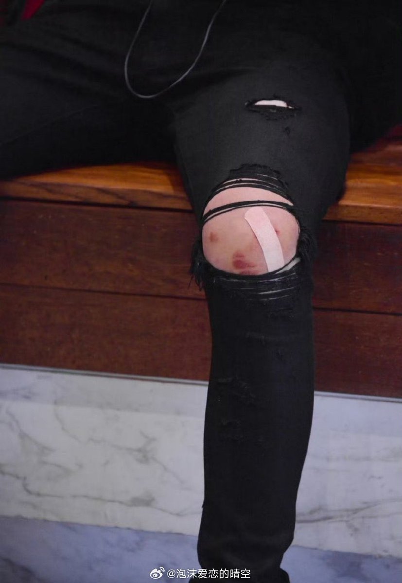 웨이보 뒤적뒤적하다가 발견한 사진인데
아니… 아들… 지금 벤드가 제역할을 못하는데…? 저거 백퍼 저래붙임 더 아픈데

좀좀 무릎보호대도 하고 형아 말좀 듣고 몸좀 아끼고 다치면 치료 제대로하고 애초에 다치지말고 제발 좀 제발