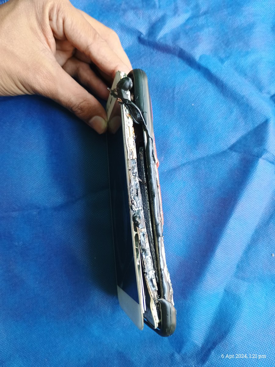 27prabin's tweet photo. Today around 12 noon, My Xiaomi MI A1 phone kept on the table at my home and suddenly exploded.  I bought this phone 6 years ago.  It was running fine, there was no such problem in it.  But today suddenly this accident happened which I was not expecting.
@XiaomiIndia 
#Mi_A1 https://t.co/KHJFT8cfIJ
