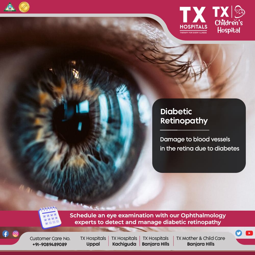 Guard against diabetic eye damage 👁️. Schedule a check-up for retinopathy management. Book Now: txhospitals.in Call Now: 9089489089 #DiabeticRetinopathy #EyeHealth