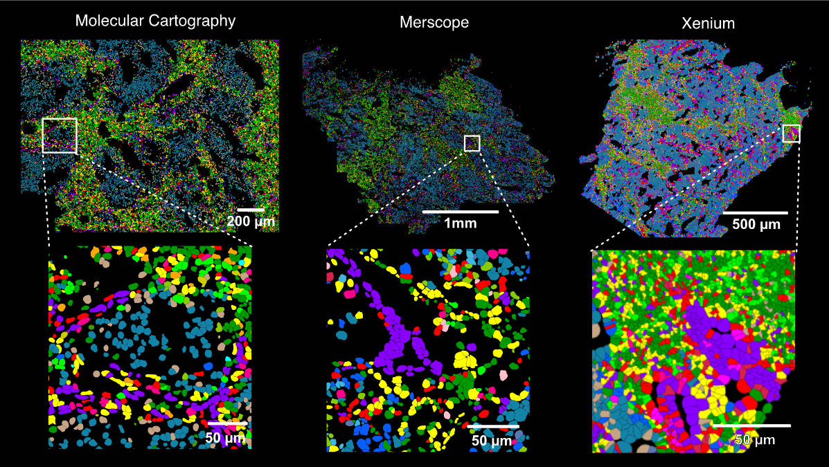 Which of the different spatial transcriptomics (ST) technologies should you use for your research? The lessons we have learnt from comparing RNAscope, Molecular Cartography (MC), Merscope, Xenium and Visium are now on bioRxiv doi.org/10.1101/2024.0… 🧵