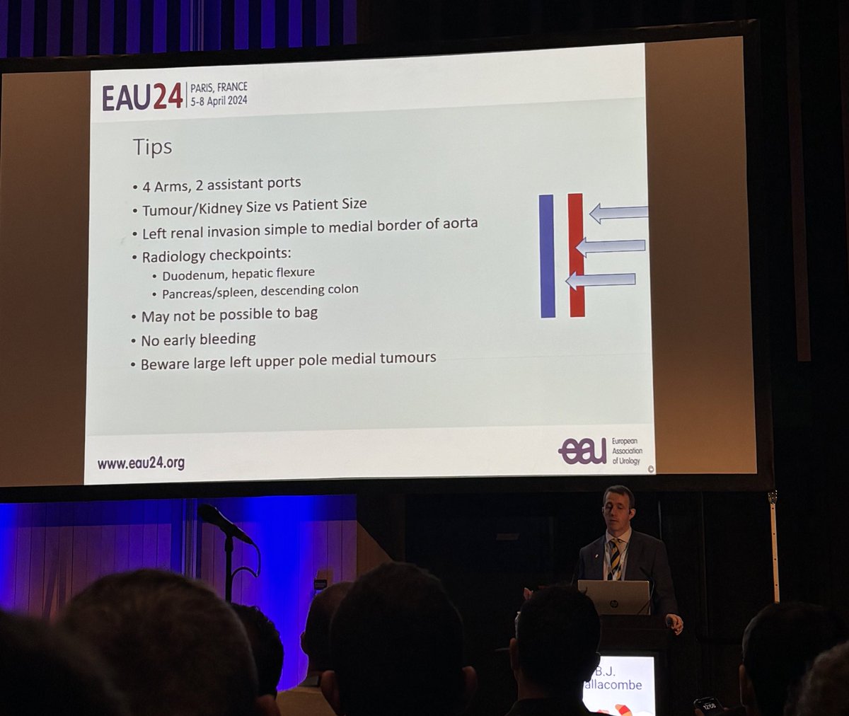 Fantastic upper tract masterclass at EAU by @benchallacombe @aleantonellibs1 @Ruben_De_Groote Plenty of tips and tricks with some fantastic cases. “Go slow to go fast” @Uroweb #EAU #EAU24