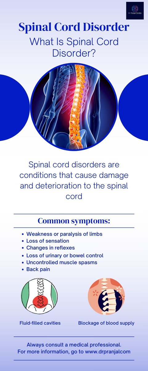 DrPranjalPandey's tweet image. Dr. Pranjal Pandey for Spinal Disorders Specialist in Delhi
Schedule an Appointment: +91-8800924351
#spineneuroindelhi #drpranjal #spinaldisorder