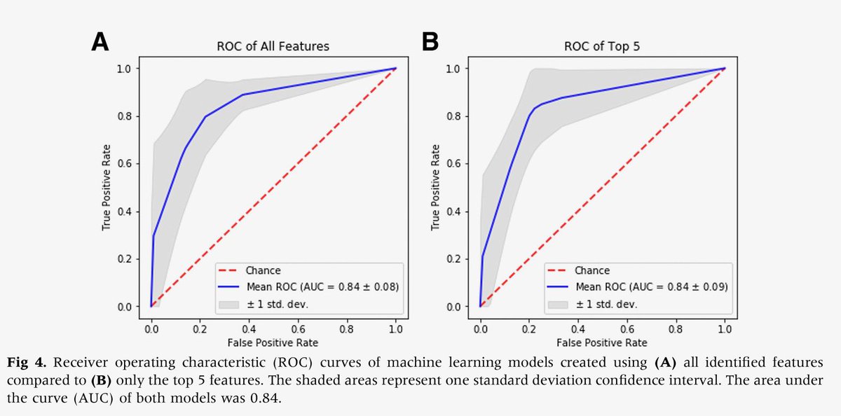 How can #AI & #MachineLearning (ML) help in the shoulder? ML was able to correctly identify #subscapulairs tears on MRI in 85% of patients (which is far better than most studies looking at human sensitivity)… sciencedirect.com/science/articl… @JacobOeding @ArthroscopyJ @JSanchezSotelo