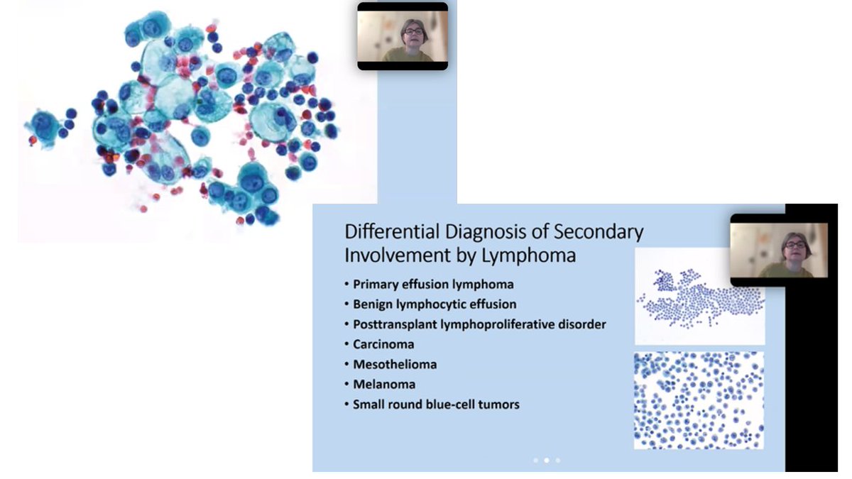 britishcytology tweet picture