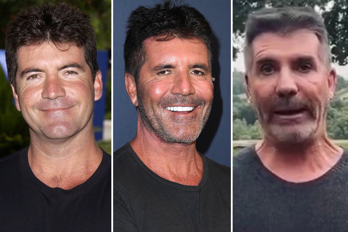 What happened to Simon Cowell?