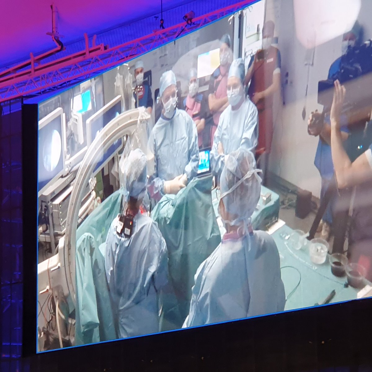 Bartosz Dybowski (@bdybowski) on Twitter photo Finally Polish surgeon in live surgery at <a href="/Uroweb/">European Association of Urology (EAU)</a> congress #EAU24
Especially proud because this is <a href="/ewabres/">Ewa Bres-Niewada</a> !!!! 👏👏👏With 🇵🇱🇩🇪 ECIRS. In and with 🇧🇪 colleagues. I believe also 1. time ever such int team 🤝 😁 Finally Polish surgeon in live surgery at <a href="/Uroweb/">European Association of Urology (EAU)</a> congress #EAU24
Especially proud because this is <a href="/ewabres/">Ewa Bres-Niewada</a> !!!! 👏👏👏With 🇵🇱🇩🇪 ECIRS. In and with 🇧🇪 colleagues. I believe also 1. time ever such int team 🤝 😁
