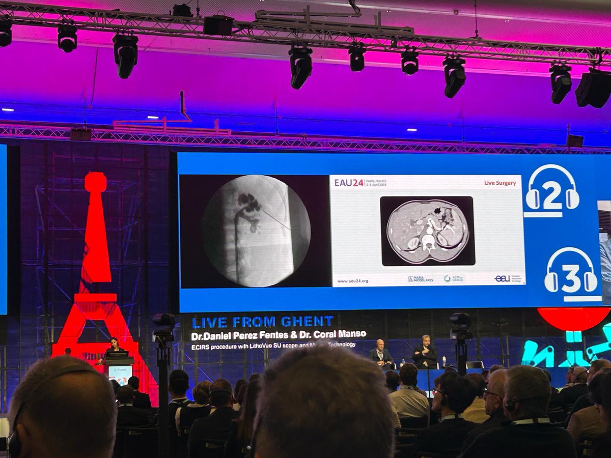 dperfen's tweet photo. Live surgery in Ghent, performing a very challenging case of MiniECIRS through an intercostal access. It was an honor to team up with @CoralManso in this surgery. Thanks to @AlbertoBreda1 and @Uroweb for the invitation to participate in the live surgery session at #EAU24 https://t.co/eS5alDVr0J