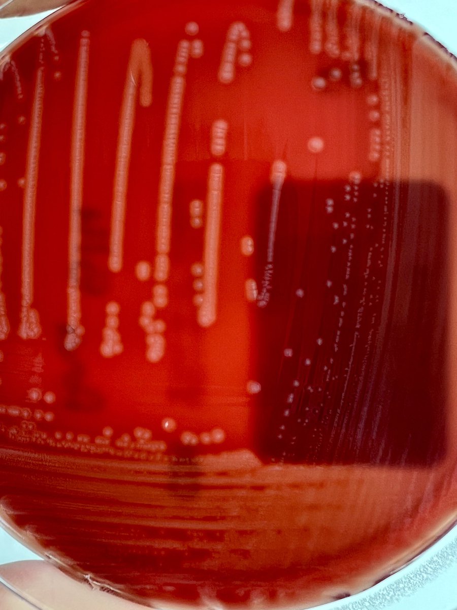#BacterioMed Quizz Hémoculture positive à …. ?🥁 Un indice : maladie à déclaration obligatoire.