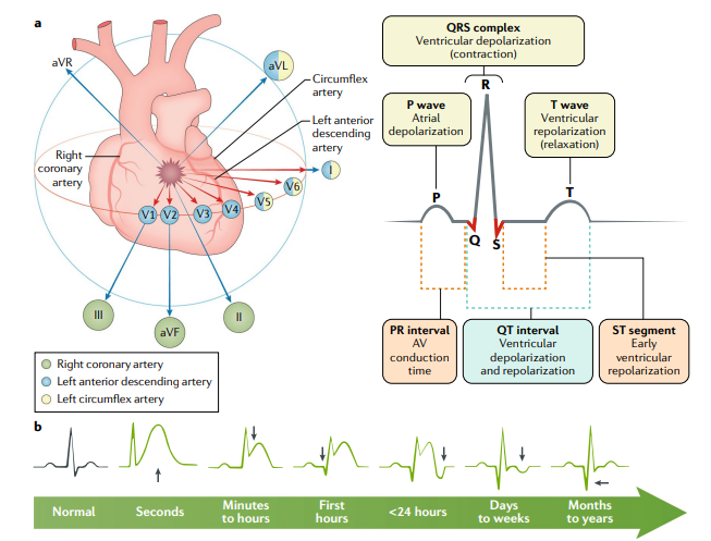 rksanti's tweet photo. 🫀Infarto de miocardio con elevación del segmento ST: Una excelente revisión de Nature 2019💯
✳️Fisiopatología
✳️Diagnóstico
✳️Tratamiento
✳️El infarto de miocardio con elevación del segmento ST (STEMI) es la manifestación más aguda de la enfermedad de las arterias coronarias y https://t.co/gQ6cUaVBGT