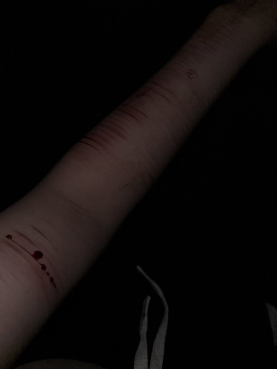 l919_99's tweet photo. #自残 #自傷行為 #自伤 #リスカ  #アムカ #scars https://t.co/ddlxD8KQkH