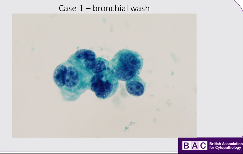 britishcytology tweet picture