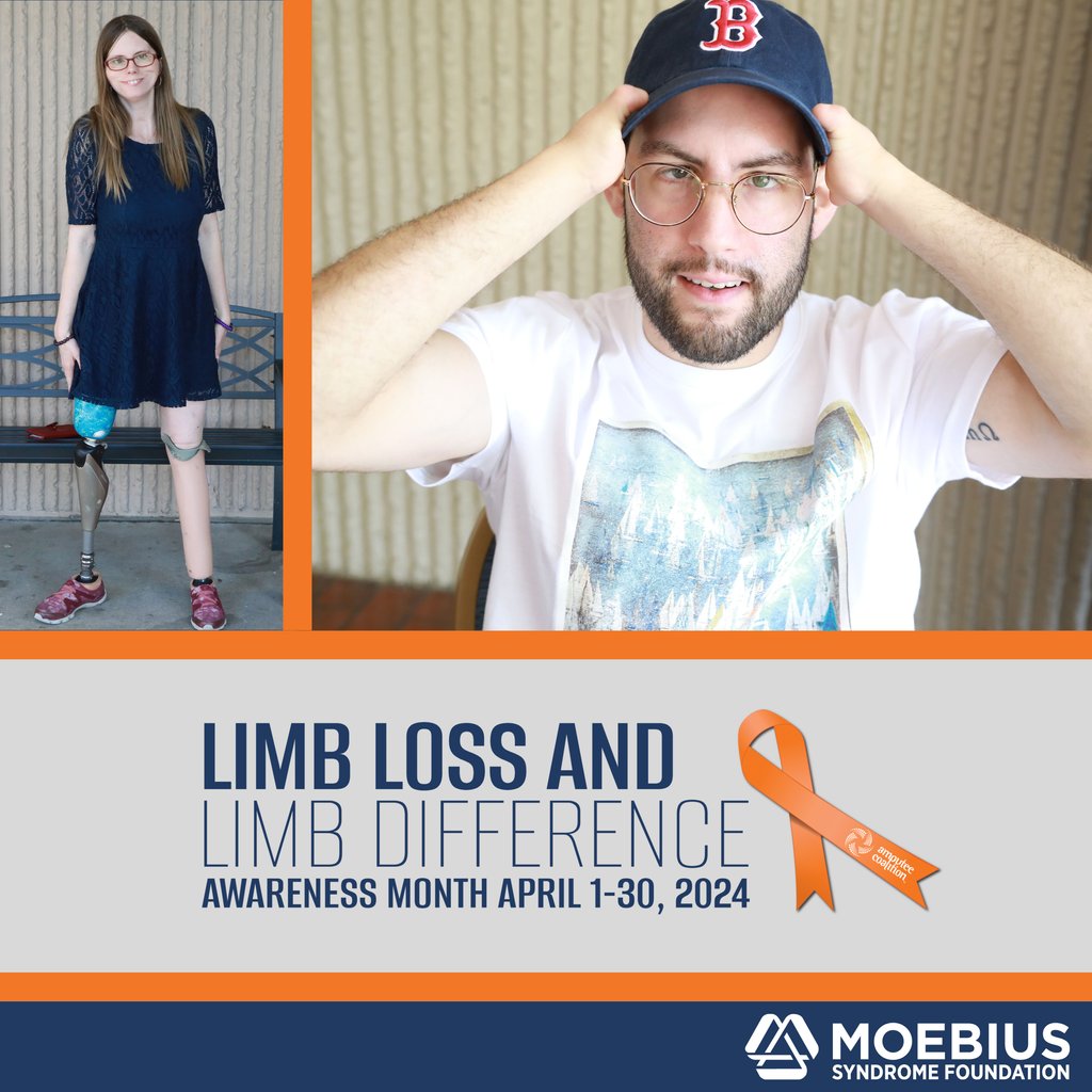 MoebiusSyndrome's tweet image. April is Limb Loss and Limb Difference Month. #LimbDifferences may occur in people with #MoebiusSyndrome, such as clubfoot, hand differences, and congenital amputation or missing digits. Learn more about #LLLDAM2024: amputee-coalition.org/events-program… #AmputeeCoalition #LLLDAM