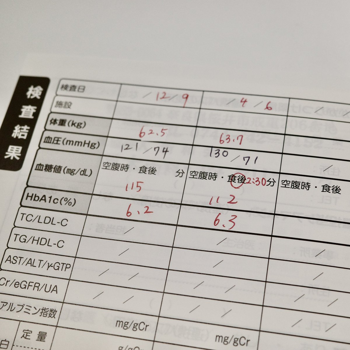 T1D_Takahiro's tweet image. 定期検診🏥

ポンプ後初の血液検査の結果は、HbA1c 6.3%でした📈
前回(12月)より0.1%アップですが、
SAPのおかげで低血糖が激減したのでその分の上がりかなと

ケアリンクのGMI値(≒HbA1c)も6.3-6.4%だったので
ガーディアン4センサの精度、そこそこ良いのでは🤔

#1型糖尿病 #780G