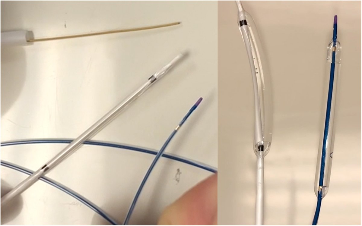 Utilization of a Small-Caliber Balloon Dilator for #Endoscopic Ultrasound-Guided #Hepaticogastrostomy Creation: Case Series ow.ly/3x5b50R6tOX @markhanscommd