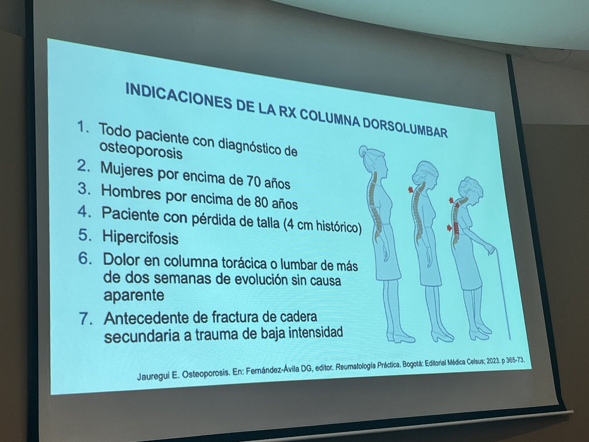 doctoravanegas's tweet photo. - Cualquier médico debe poder ordenar densitometría ósea y diagnosticar y tratar pacientes con osteoporosis.
- Principal fx por osteoporosis: vertebral y por eso es importante tamizar con rx columna dorsolumbar.
- Fx vertebral grave o 2 o + de cualquier gravedad: osteoformador https://t.co/EWnaySI7CM