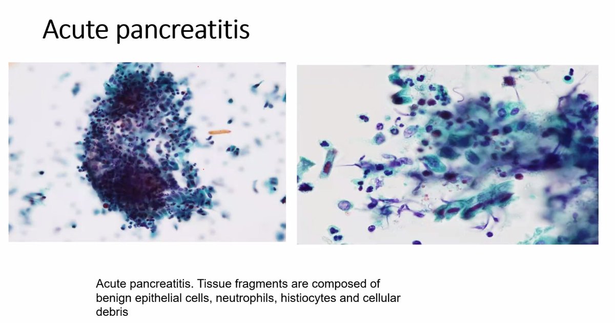 britishcytology tweet picture