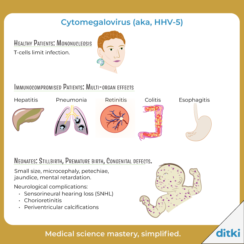 Don't waste time - use Ditki in your Infectious Disease course, and master science, faster! l8r.it/Wysm #ditki #usmle #meded #medschool #immunology #microbiology #infectiousdisease #HHV #nursing #physicianassistant #medicine #science #healthscience #nurse #premed