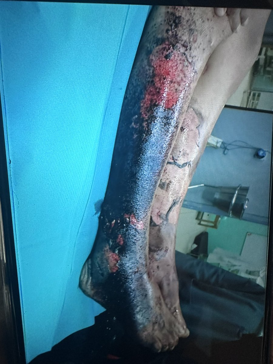 Mark Perlmutter MD tweet media