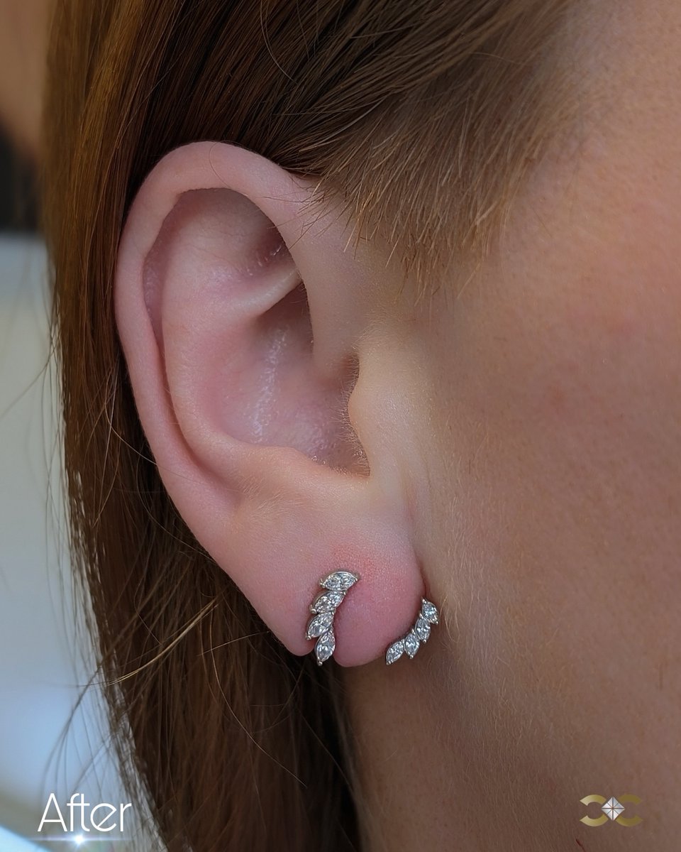 PiercerCharlie's tweet image. Transform your look with our exclusive ear curation services. Our client asked us to cover the earlobe slit and we found this creative way to decorate her earlobe! 💫✨ #ExclusivePiercings #PrecisionStyling #ElegantAdornments #EarArtistry&quot; piercercharliescreations.ie/piercing/